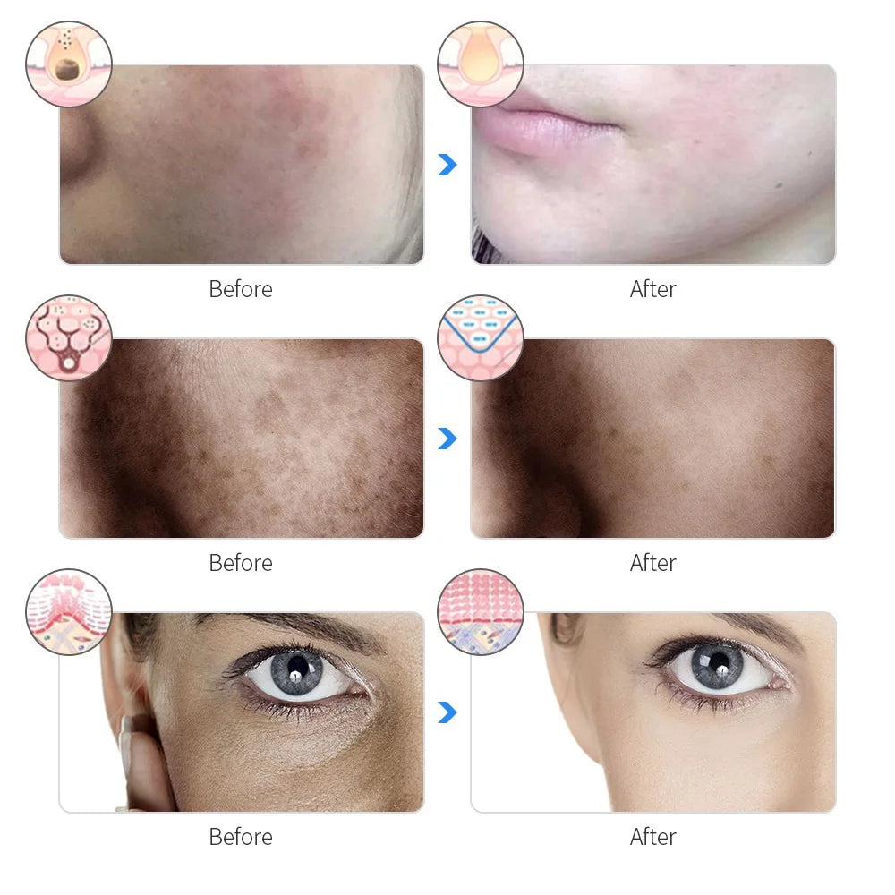 Rechargeable 7-Color LED Facial Mask – Skin Rejuvenation & Face Lifting Beauty Device for Home Use